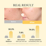 [Abo 40% Rabatt] Kojic Acid Turmeric Gold Jelly Gel Mask