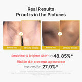 Kojic Acid Turmeric Body Peel Shot