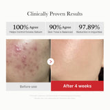 [Abo 40% Rabatt] Red Succinic Acid Panthenol Pads