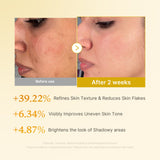 [Abo 40% Rabatt] Kojic Acid Turmeric Toner