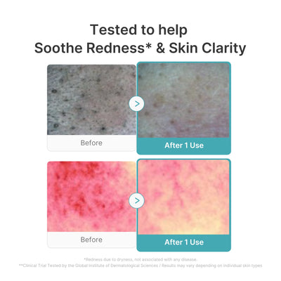 Azelaic Acid Capsule Foam Cleanser