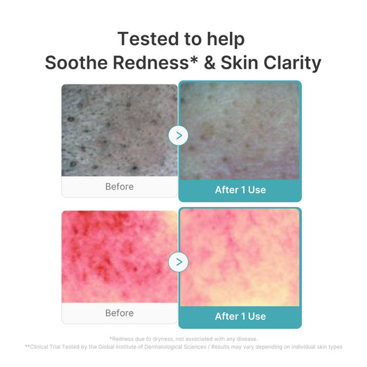 Azelaic Acid Capsule Foam Cleanser