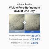 [GIFT] Zero Pore One-day Peptide Serum