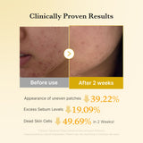 [GIFT] Kojic Acid Turmeric Toner Pad