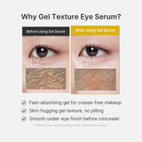 Kojic Acid Turmeric Eye Gel Serum