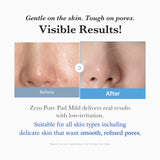 [Abo 40% Rabatt] Zero Pore Madecassoside Pads (Mild)