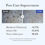 [Abo 40% Rabatt] Zero Pore Blackhead Mud Mask
