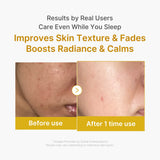 [Abo 40% Rabatt] Kojic Acid Turmeric Overnight Wrapping Mask