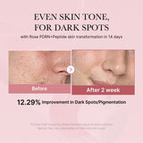 [Abo 40% Rabatt] PDRN Pink Peptide Toner