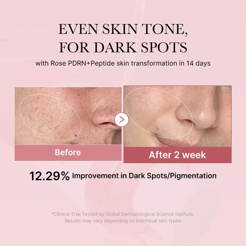 [Abo 40% Rabatt] PDRN Pink Peptide Toner