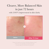 [Abo 40% Rabatt] TXA Niacinamide Serum